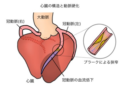 心臓の構造と動脈硬化