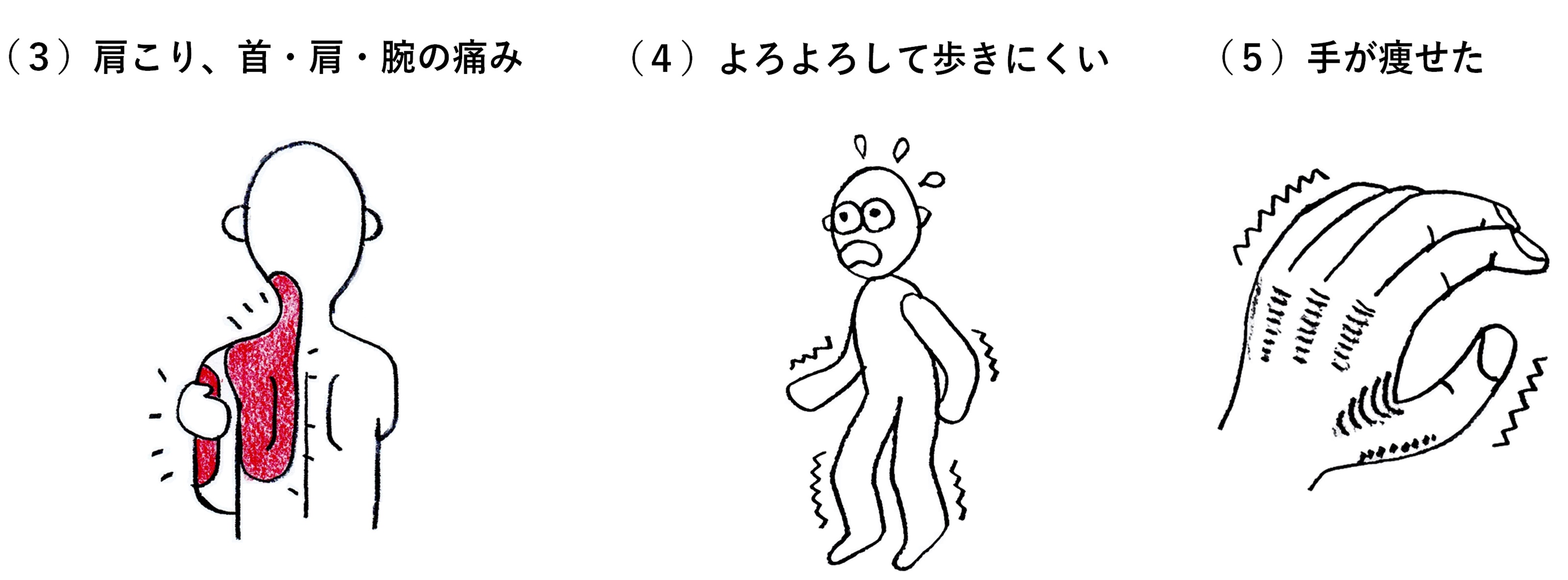 頸椎症について 晴生会さっぽろ南病院