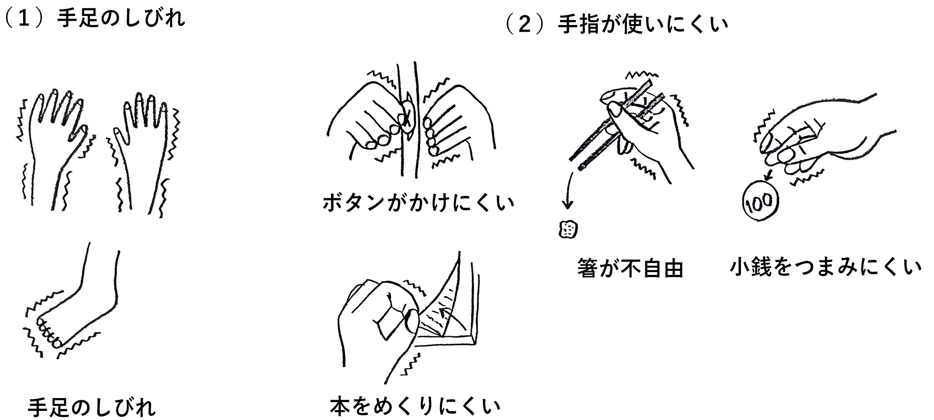 頸椎症について 晴生会さっぽろ南病院